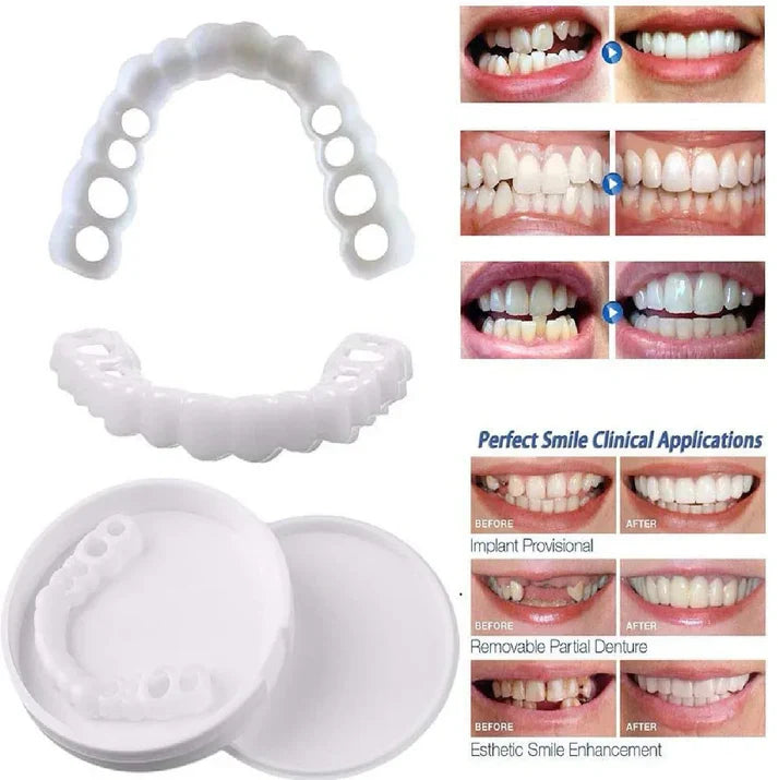 CARILLAS DENTALES-SNAPON SMILE