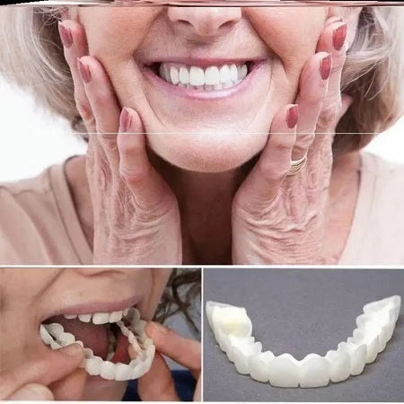 CARILLAS DENTALES-SNAPON SMILE