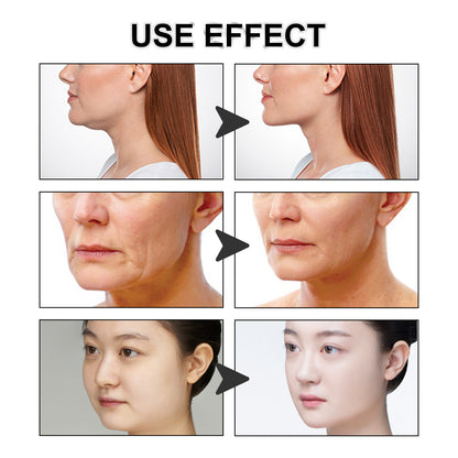 SculptEase™Cintas faciales lifting